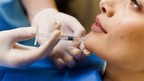 Do Dermal Fillers Hurt? What to Expect During Facial Injections