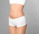 What is a Mini Tummy Tuck? A Comprehensive Guide