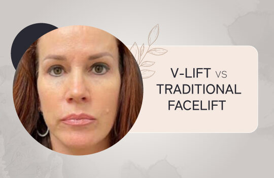 V-Lift vs. Traditional Facelift: Which Procedure is Right for You?