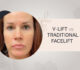 V-Lift vs. Traditional Facelift: Which Procedure is Right for You?