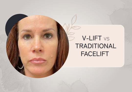 V-Lift vs. Traditional Facelift: Which Procedure is Right for You?