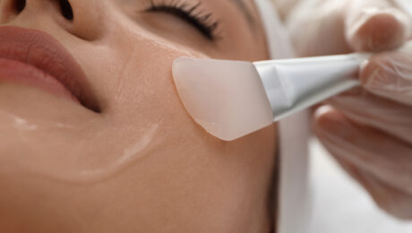 How Professional Chemical Peels Can Transform Your Skin’s Texture