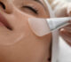 How Professional Chemical Peels Can Transform Your Skin’s Texture