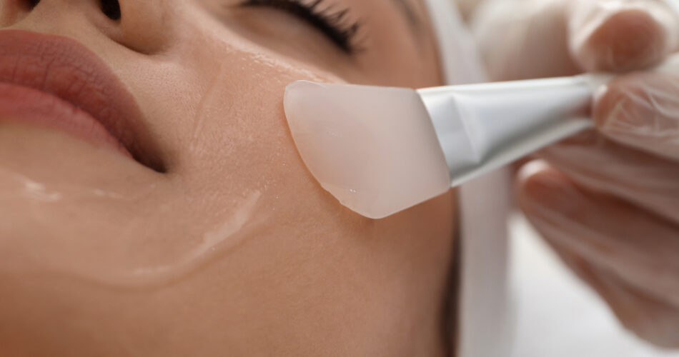 How Professional Chemical Peels Can Transform Your Skin’s Texture